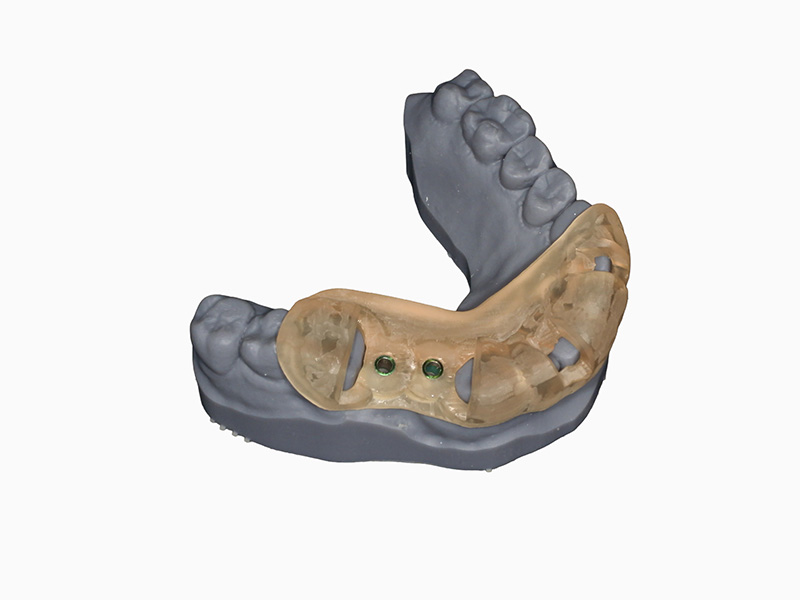 サージカルガイド